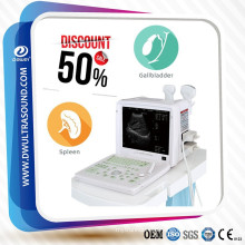 DW360 2D USG Portable Ultrasound Machine Price